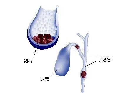 ίđY(ji)ʯ׳F(xin)ʯ(yng)